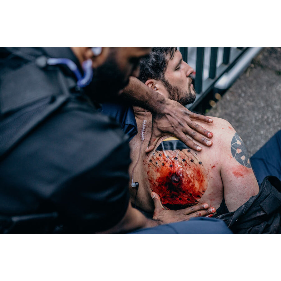 SAM Chest Seal